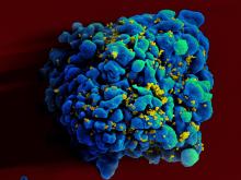 Scanning electromicrograph of an HIV-infected T cell