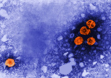transmission electron microscopic image of hepatitis B virus particles