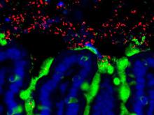 Infant gut bacteria microscopy image