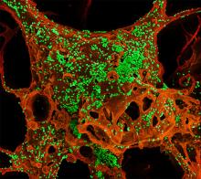 Color-enhanced scanning electron micrograph of cells infected with Middle East respiratory syndrome coronavirus (MERS-CoV).