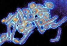 Colorized electron micrograph of Marburg virus