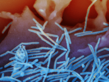 Image of RSV virions