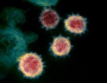 Partículas del virus 2019-nCoV virus emergiendo de la superficie de una celular cultivada en laboratorio