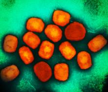 Monkeypox virus (orange circles) on green background.