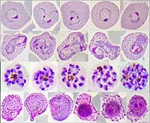 Red blood cell stages of Plasmodium vivax from malaria patients in Thailand.