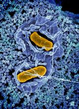 Scanning electron micrograph of Salmonella Typhimurium invading a human epithelial cell.