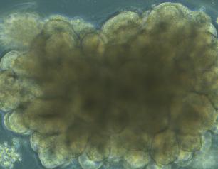Brightfield microscope image of an organoid during development, showing highly structured regions forming.