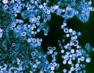 Round particles of Lassa virus Josiah strain shown budding from cells