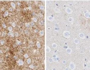 Mouse brain infected with scrapie (2019 JCI treatment ASO study)