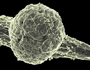 Ebola virus Makona covering the surface of an infected cell.