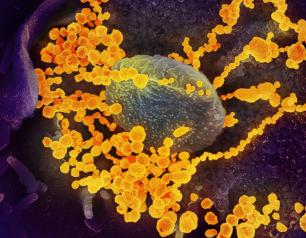 SARS-CoV-2, the virus that causes COVID-19.