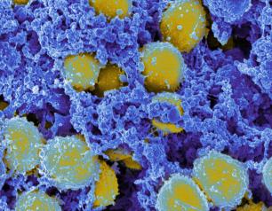 Scanning electromicrograph of Staphylococcus aureus bacteria.