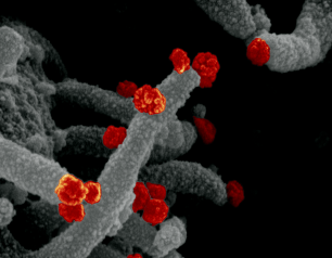 This scanning electron microscope image shows SARS-CoV-2 (round red particles) emerging from the surface of a cell cultured in the lab. 