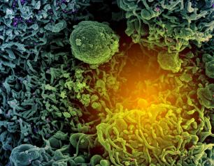 This colorized scanning electron micrograph shows a cell (teal and green) infected with SARS-CoV-2 virus particles (purple and pink) isolated from a patient sample.