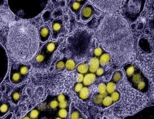 SARS-CoV-2 virus particles