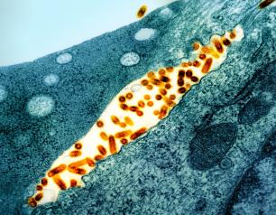 This transmission electron micrograph shows vesicular stomatitis virus particles colored orange budding from infected cells colored teal.