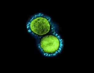 This transmission electron micrograph shows SARS-CoV-2 virus particles isolated from a patient sample and cultivated in cell culture. 