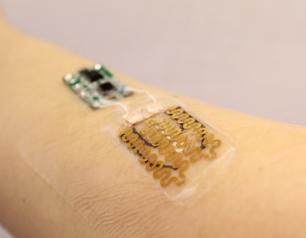 prototype of a smart bandage equipped with temperature and pH sensors