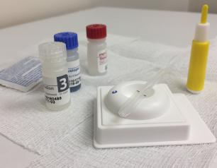 HIV Antibody Testing Kit