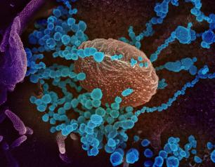SARS-CoV-2 (round blue objects) emerging from the surface of cells