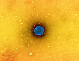 Transmission electron micrograph of a SARS-CoV-2 virus particle