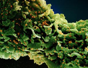Colorized scanning electron micrograph of a cell infected with a variant strain of SARS-CoV-2 virus particles (UK B.1.1.7), isolated from a patient sample.