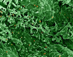 Colorized scanning electron micrograph of mpox virus on the surface of infected VERO E6 cells