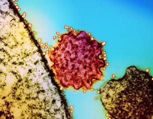 Colorized transmission electron micrograph of a single Nipah virus particle