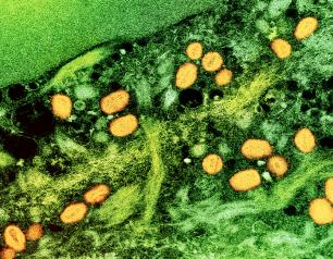 mpox particles in an infected cell.