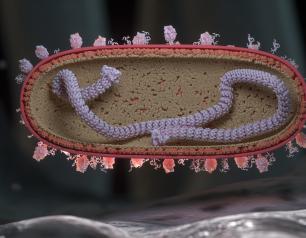 Respiratory syncytial virus (RSV) in cross-section landing on the surface of a human respiratory endothelial cell. Single stranded RNA (colorized purple) is shown wrapped around a nuclear protein core capped by large L proteins.