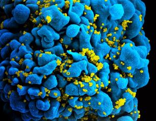 HIV-infected T-cell