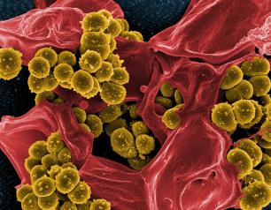 Methicillin-resistant Staphylococcus aureus bacteria