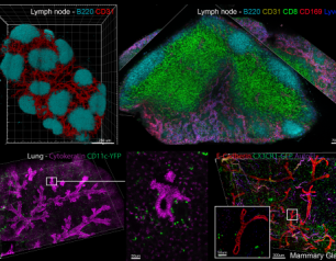 3D reconstruction of lymph node, lung and mammary gland