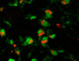 microglial cells (green) are engulfing and eliminating prion-damaged photoreceptors (red), which appears to slow retinal degeneration