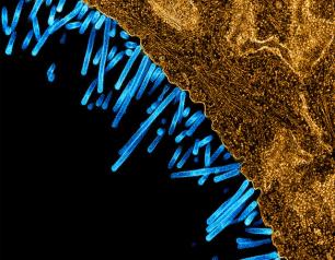 swine influenza virus particles attached to and budding off a cell