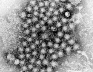  A cluster of circular hepatitis virus particles, as captured by a transmission electron microscope.