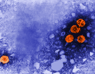 transmission electron microscopic image of hepatitis B virus particles
