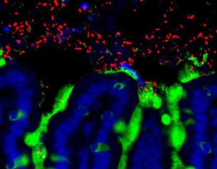 Infant gut bacteria microscopy image