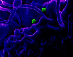 MERS virus particles on camel epithelial cells