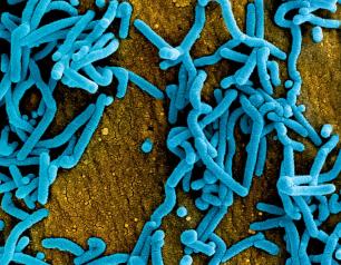 SEM image of rod-shaped Marburg virus particles, colorized blue.