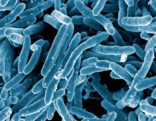 Scanning electron micrograph of Mycobacterium tuberculosis bacteria which cause tuberculosis