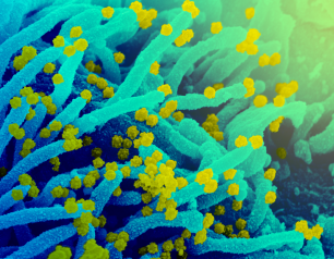 Scanning electron microscope image showing SARS-CoV-2 emerging from the surface of a cell