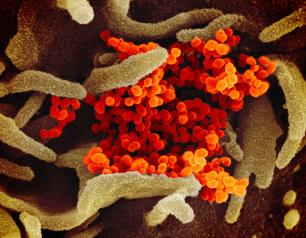 SEM image of SARS-CoV-2 emerging from cultured cells