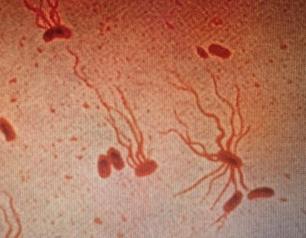 S. Typhi shown under a microscope