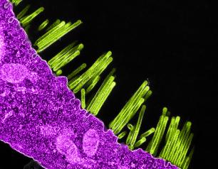 A picture of swine flu virus particles budding from the surface of a cell.