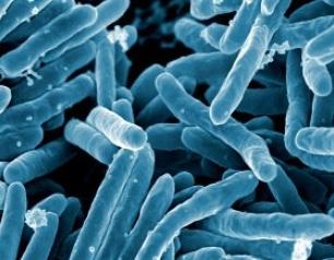 A scanning electron micrograph of Mycobacterium tuberculosis, the bacteria which causes tuberculosis.