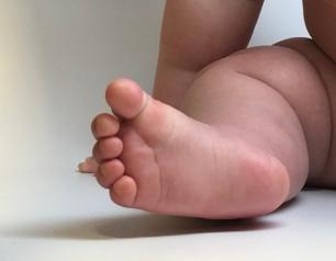 A baby's foot and leg