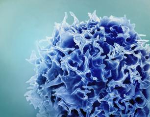 Colorized scanning electron micrograph of a T cell (blue).