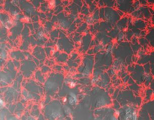 Image of fibrin deposits (red) associated with human lung epithelial cells infected with SARS-CoV-2.