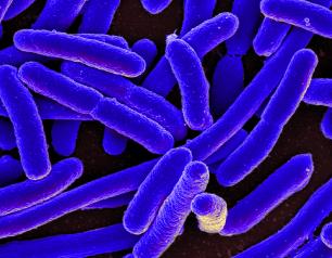 Image of E. coli bacteria